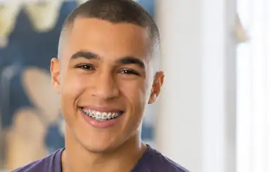 Brakets metal