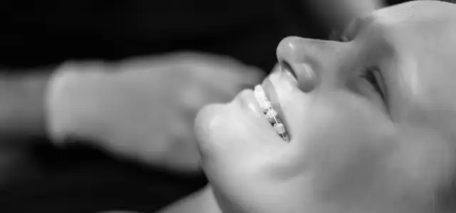 Brackets, tandfarvede og metal